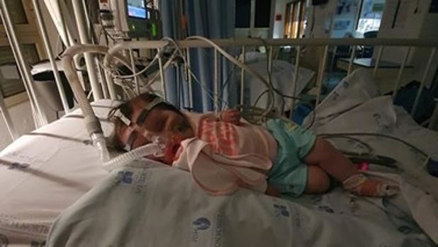 Operan de urgencia a la bebé que recibió en Portugal el medicamento más caro del mundo
